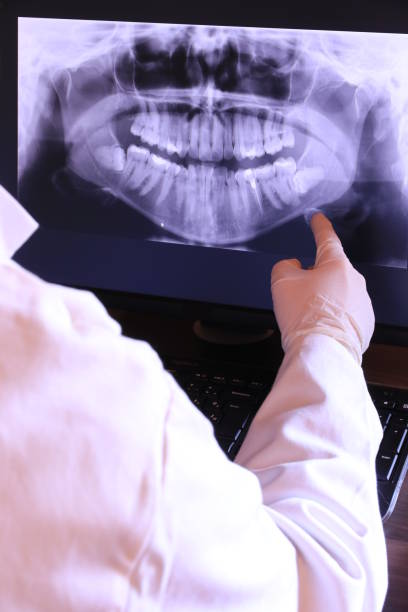 Best Emergency Dental Care for Broken or Chipped Teeth in Federal Y, WA