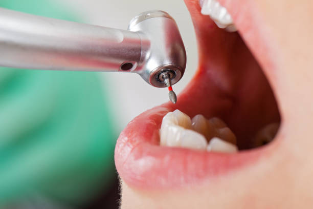 Best Emergency Gum Treatment in Federal Y, WA